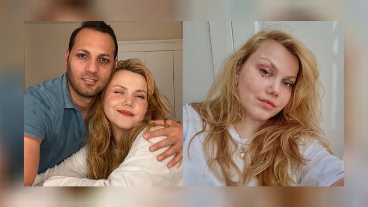 Eşi tarafından bıçaklı saldırıya uğrayan sosyal medya fenomeninden yürek yakan paylaşım