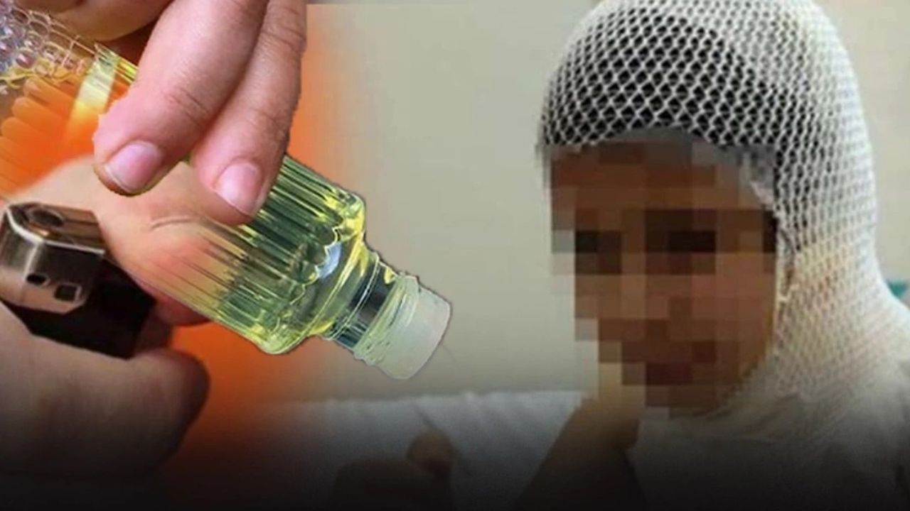 Sosyal medyada gördüğü video hastanelik etti: Aileler uyarılıyor