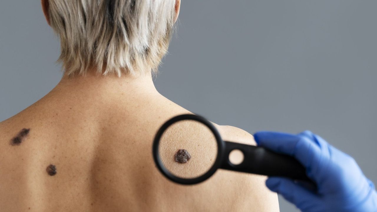 İnsanlara cilt rengini veren pigmentasyonla ilgili 135 yeni gen bulundu