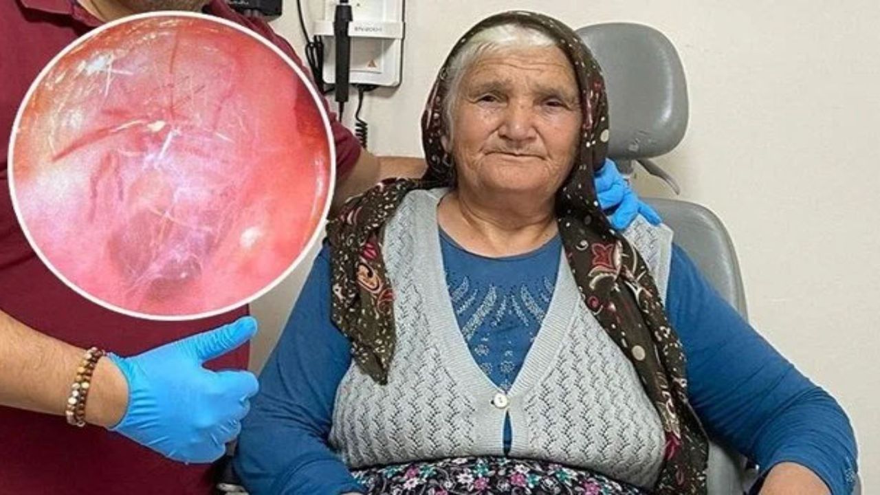 Kulağına örümcek yuvası yapan kadın şaşırttı