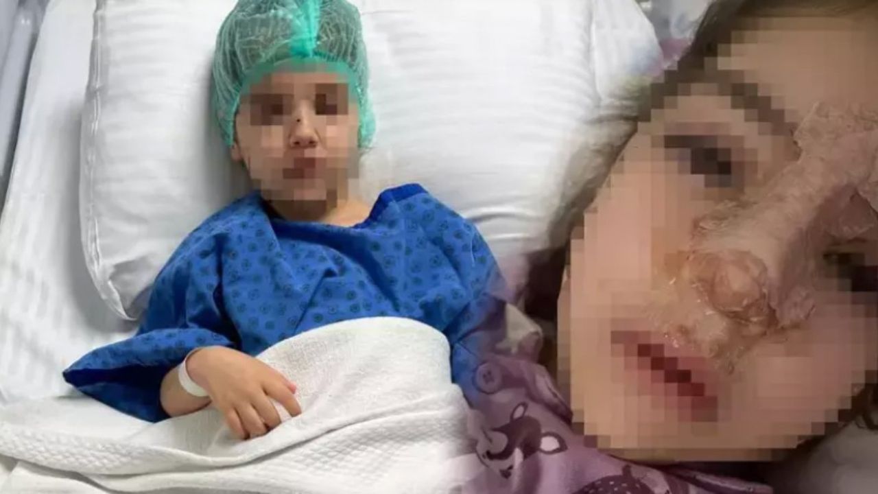 Kreşte SKANDAL! 4 yaşındaki kızın burnu okulda kırıldı