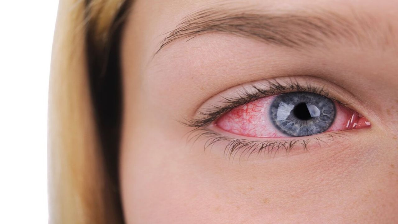 Göz hastalıklarında erken teşhis hayat kurtarıyor! Gözlerinizdeki belirtiler ciddi bir hastalığın işareti olabilir!