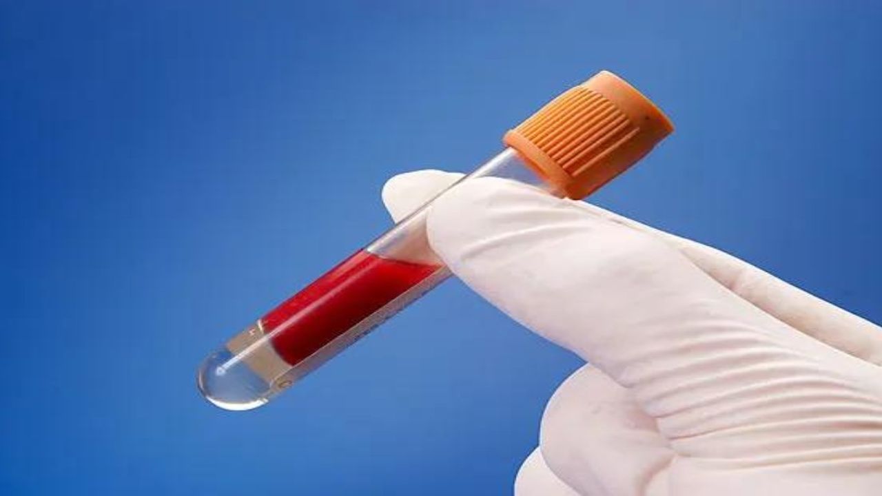 Kansızlık hayatınızı nasıl etkiliyor! Bu sinyaller neyi işaret ediyor! Kansızlık belirtileri ve tedavisi