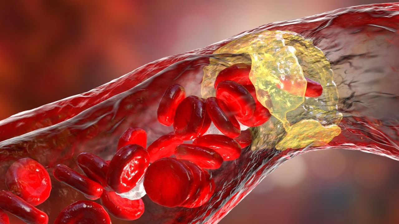 Kötü kolestrol onun olduğu yerde barınamıyor! Kalp sağlığına bire bir olan bu baharat, anne sütüne de şifa veriyor