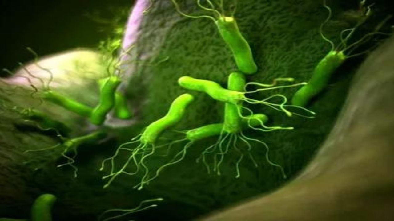 Mide şişkinliği ve hazımsızlığın asıl sebebi buymuş! Mide kanseri riskini de artırıyor! Aman bu bakteriye dikkat