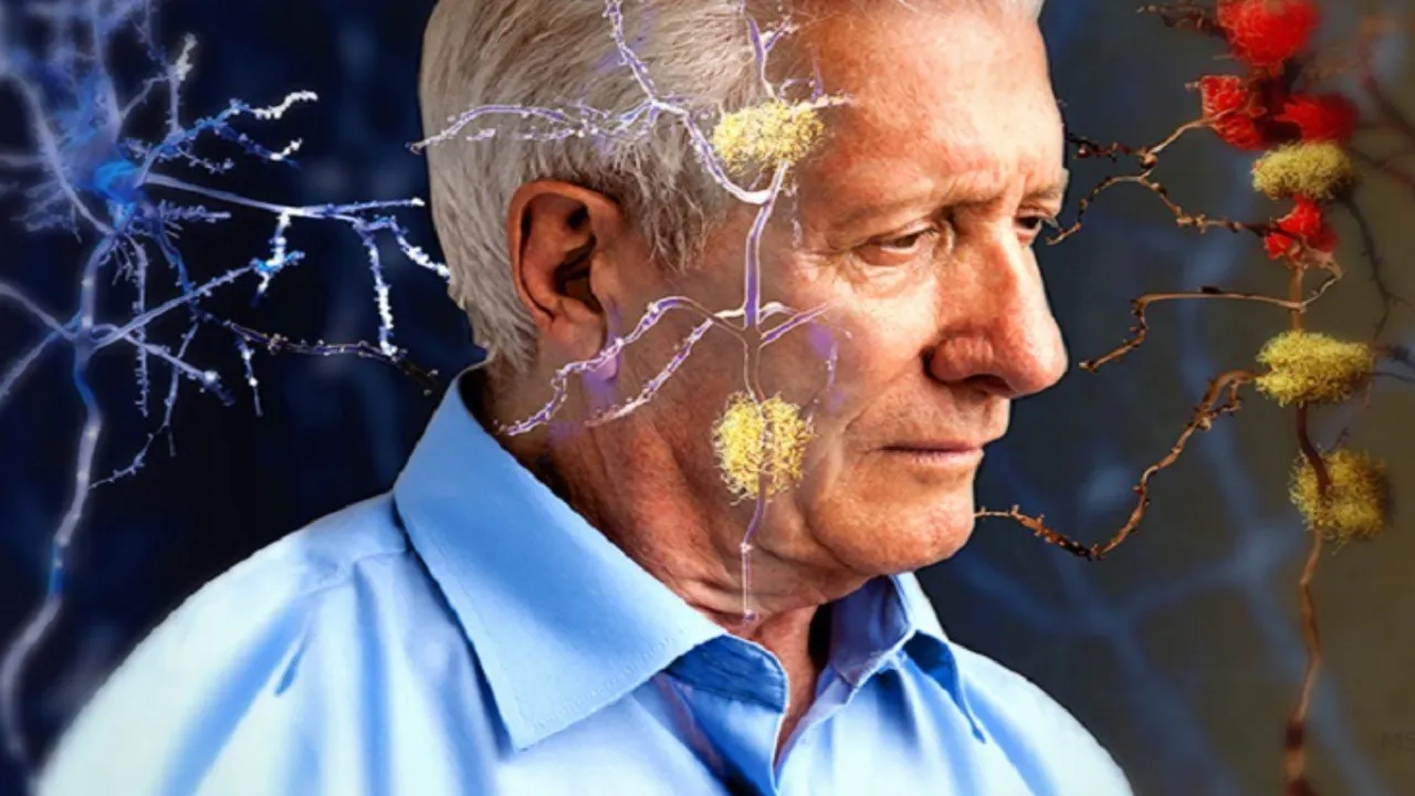 Yaygınlaşan Alzheimer hastalığına yakalanmamak isteyen bu teknikleri kullansın! İşte o liste