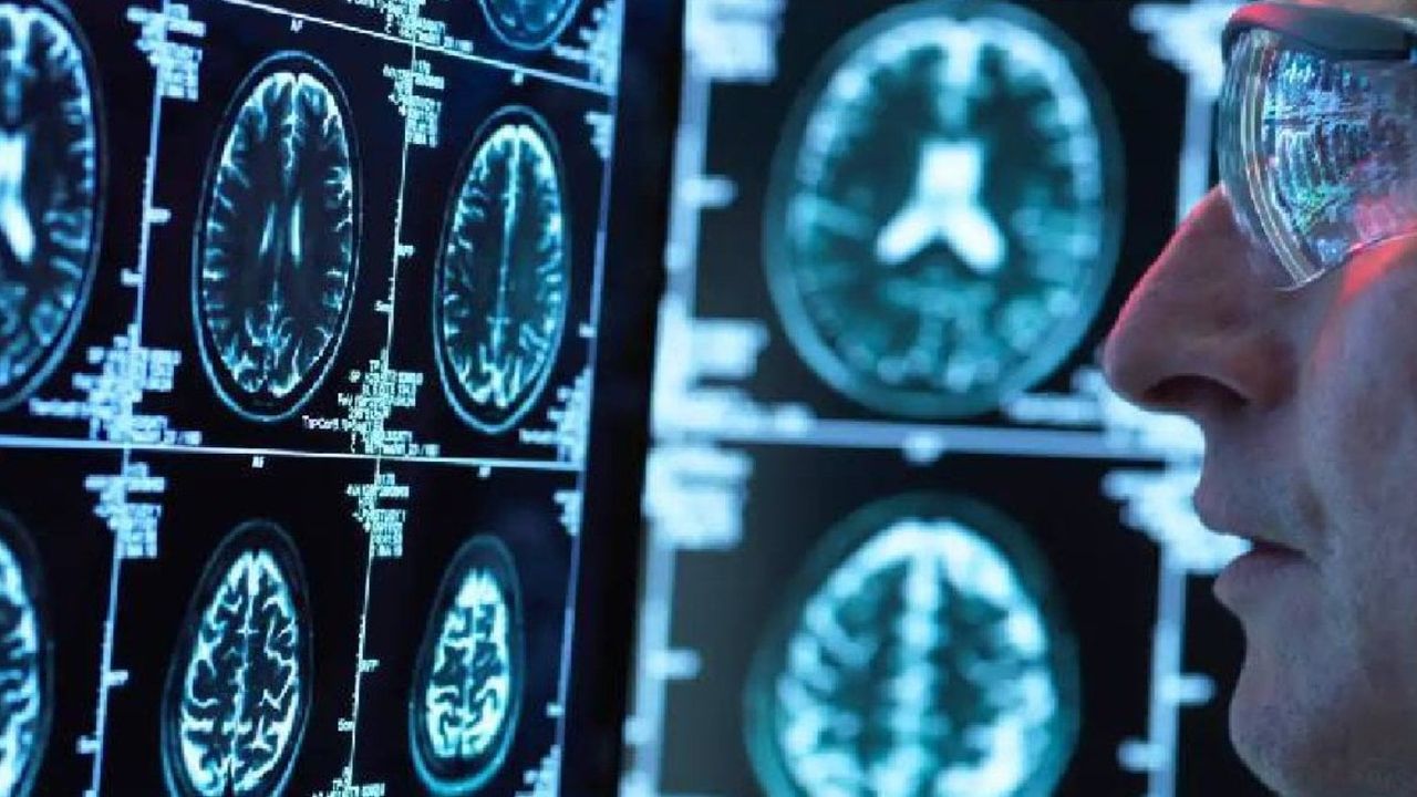 Bilim insanları Alzheimer riskini p azaltabilecek gen keşfetti