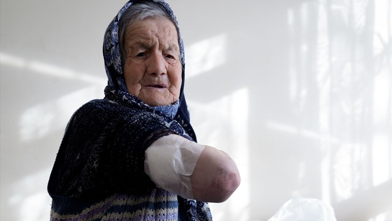 Ankara'da Sahipsiz Köpek Saldırısı: Yaşlı Kadın Yaralandı