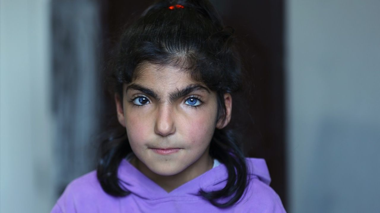 Hakkari'de Farklı Göz Renklerine Sahip Kız Kardeşler Dikkat Çekiyor