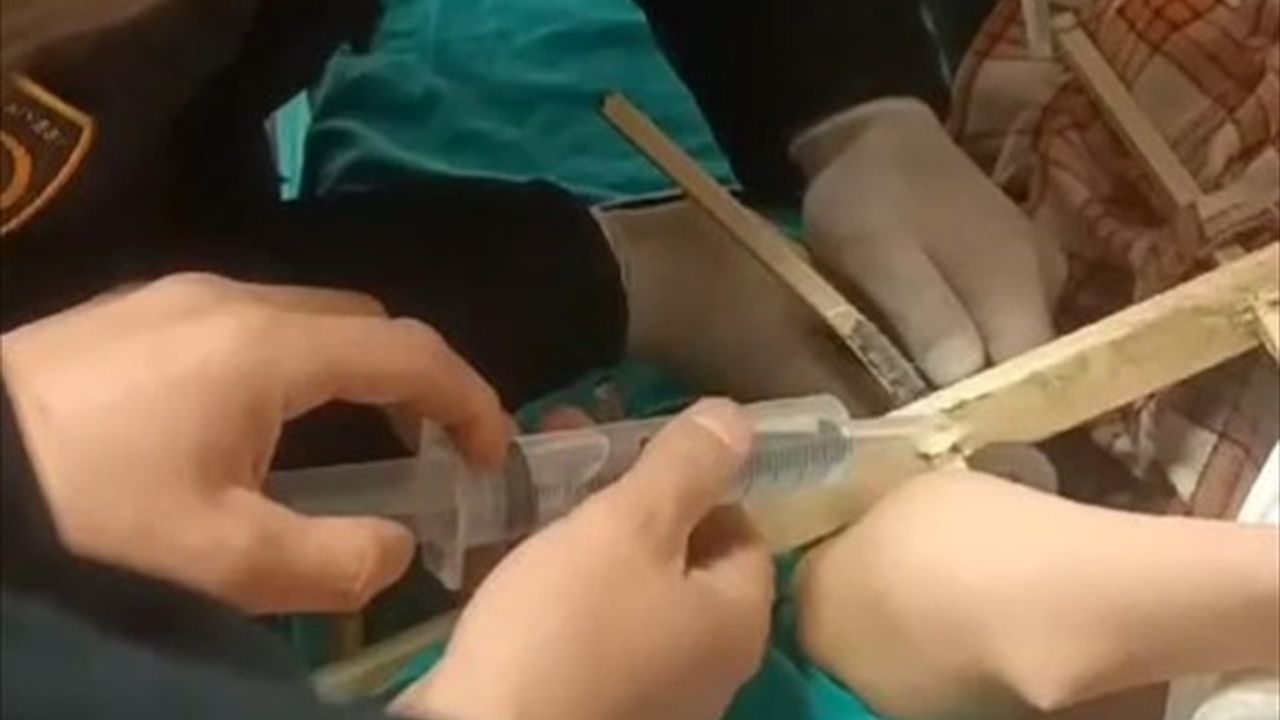 Sivas'ta Koluna Demir Parmaklık Sapan Çocuk İtfaiye Tarafından Kurtarıldı