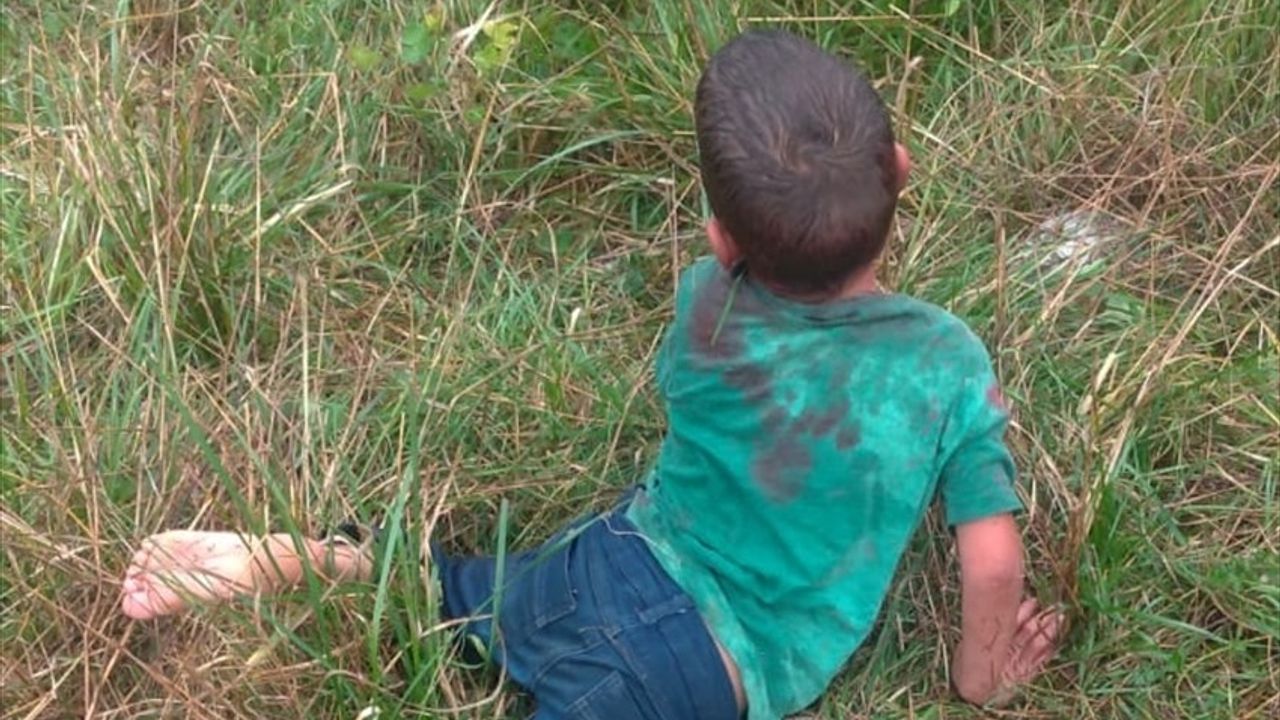 Yalova’da Sahipsiz Köpeklerin Saldırısına Uğrayan Çocuk Ağır Yaralandı