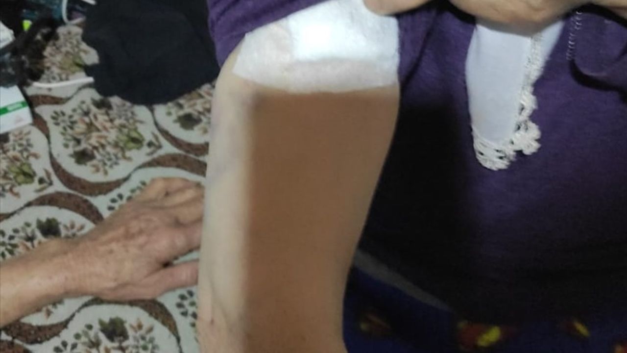 Burdur'da Sahipsiz Köpeklerin Saldırısı: 72 Yaşındaki Kadın Yaralandı