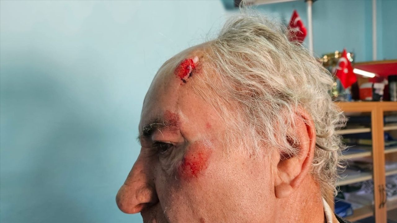 Burdur'da Sahipsiz Köpeklerin Saldırısına Uğrayan Kişi Yaralandı