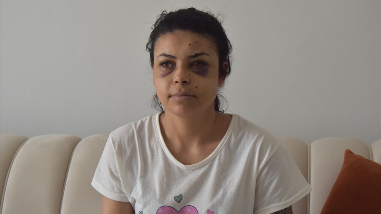 Kırklareli'nde Düğün Kavgasında Kadın Gözünden Yaralandı