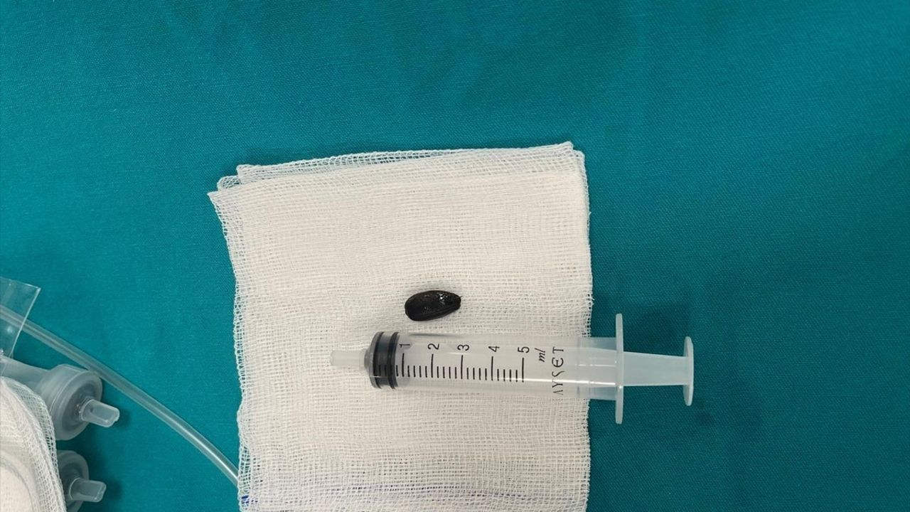 Batman'da Akciğerine Çekirdek Kabuğu Kaçan 15 Aylık Bebek Ameliyatla Sağlığına Kavuştu