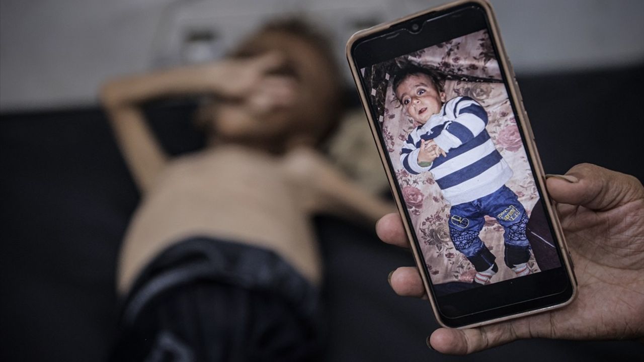 Filistinli Bebek Muhammed Zekeriya Eyyub el-Matuk'un Doktoru, Açlık İddialarını Yalanladı