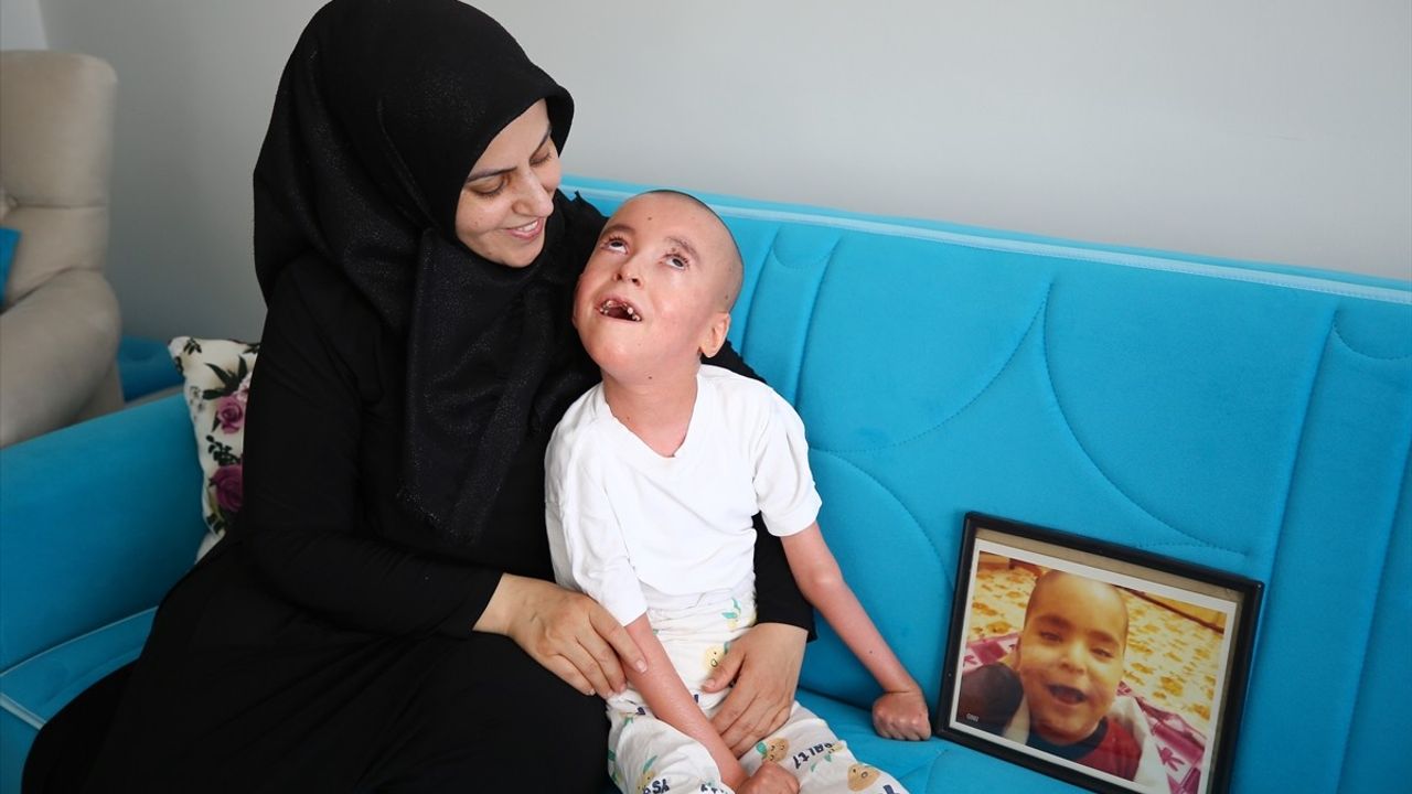 Bingöl'de iktiyozisle mücadele: Evladını kaybeden anne diğer oğluna ömrünü adadı