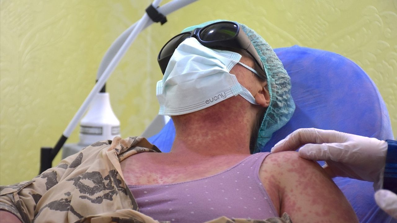 Van'da İnternetten Alınan Krem Cilt Problemlerine Yol Açtı