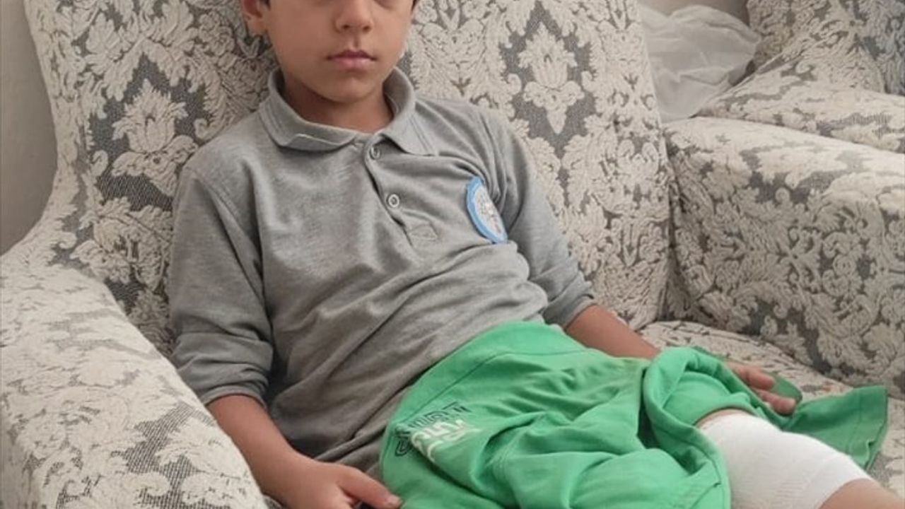 Bursa'da sahipsiz köpeğin saldırısına uğrayan 8 yaşındaki çocuk yaralandı