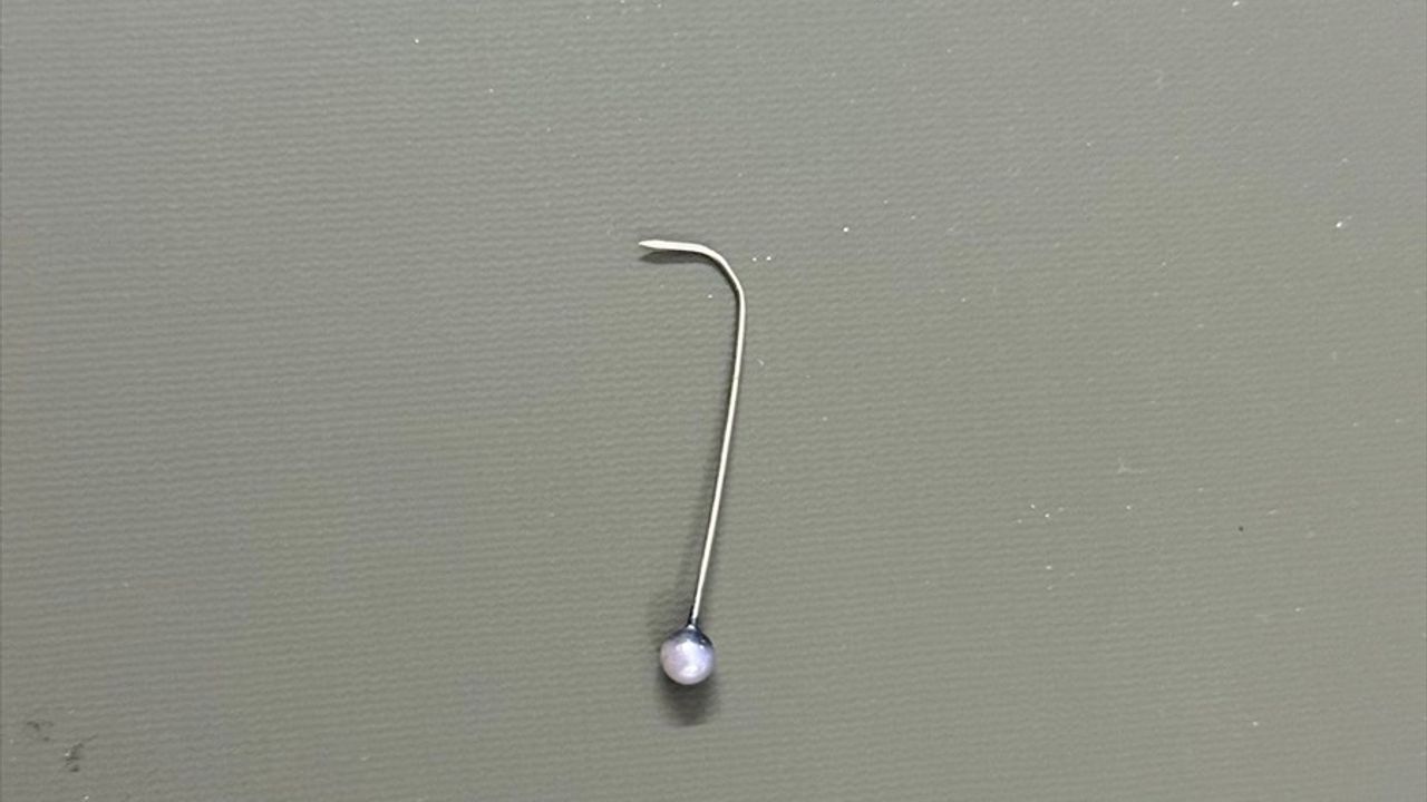 Şanlıurfa'da 16 yaşındaki kızın yuttuğu toplu iğne bronkoskopiyle sol akciğerinden çıkarıldı