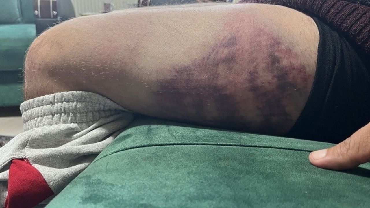 İzmit’te yüzde 85 otizmli gence odunla saldırı: Fırın çalışanı tutuklandı