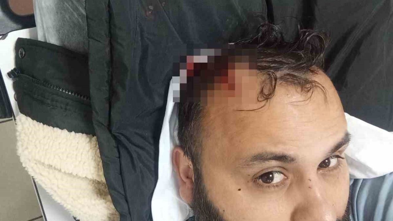 Kayseri'de kukla sanatçısı Adem Ocaktan, boşanma aşamasındaki eşi ve ailesi tarafından darbedildi