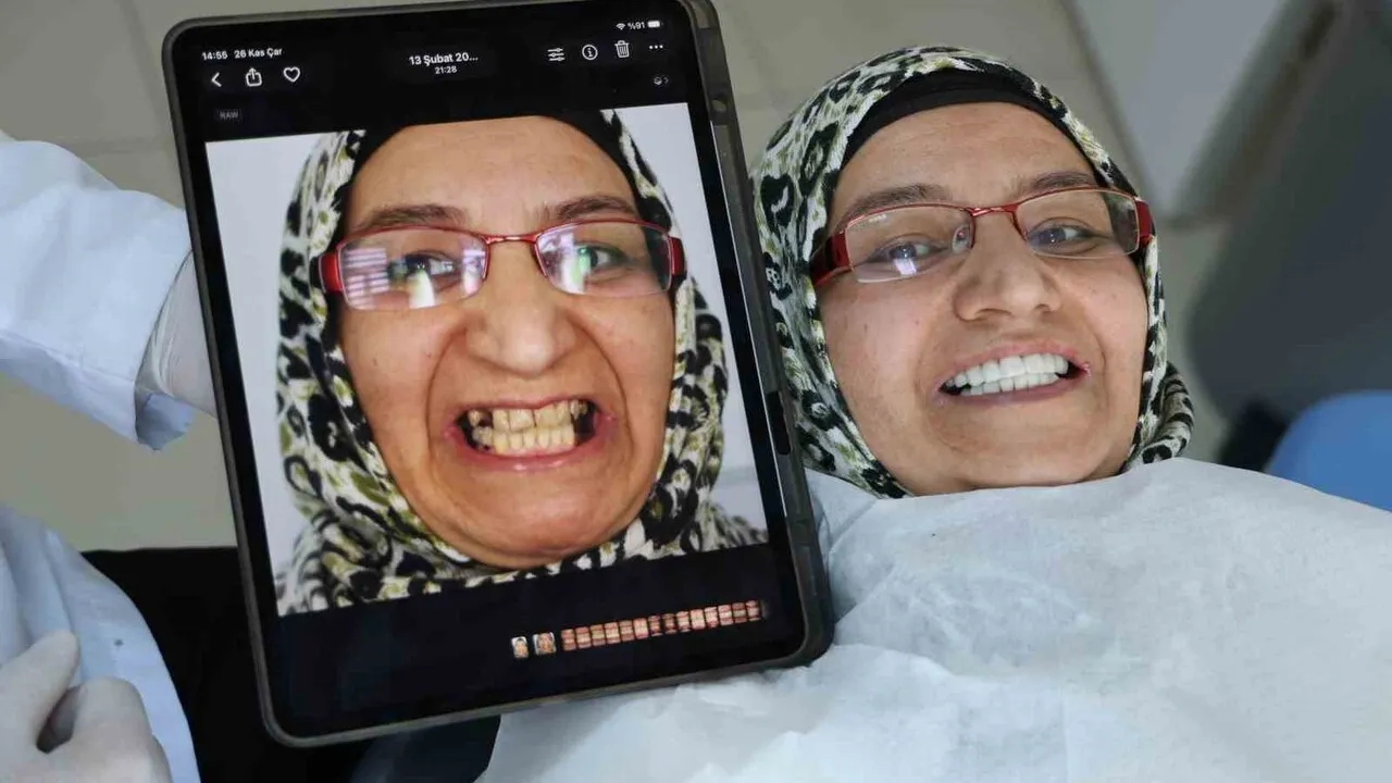 Prof. Dr. İhsan Hubbezoğlu: Cam Fiber Post ve Direkt Kompozit Lamina ile İmplant İhtiyacını Azalttı