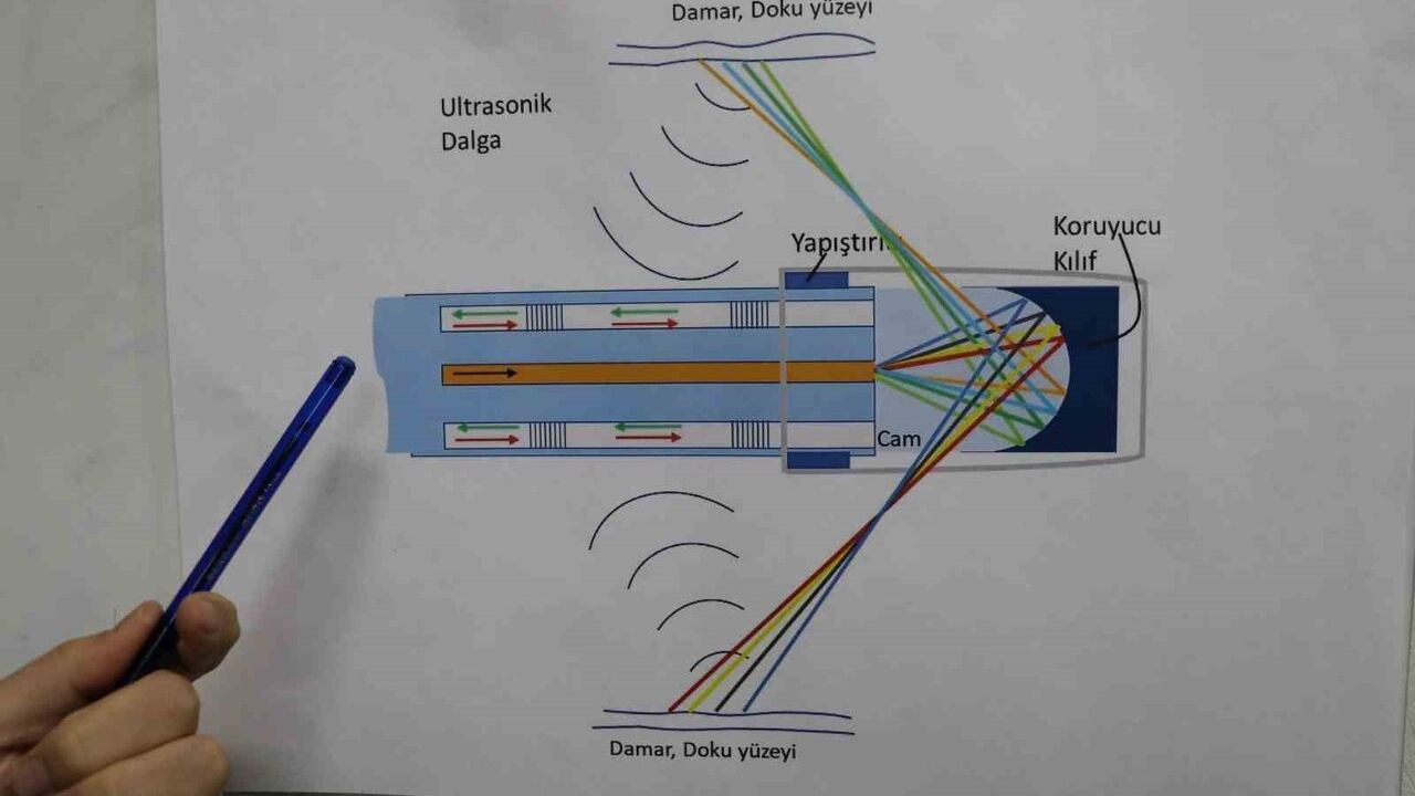 SBTÜ ve Bilkent UNAM işbirliğiyle biyopsi gerektirmeyen fiberoptik endoskopi ile damar içi kanser tespiti