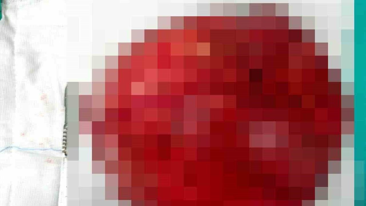 Akşehir Devlet Hastanesinde rahim kaynaklı yaklaşık 40 cm'lik kitle çıkarıldı