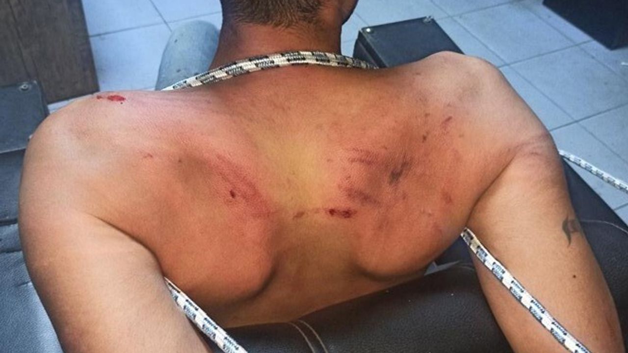 Antalya işyeri işkence davasında karar: Yağmadan beraat, hürriyeti kısıtlamadan hapis cezaları