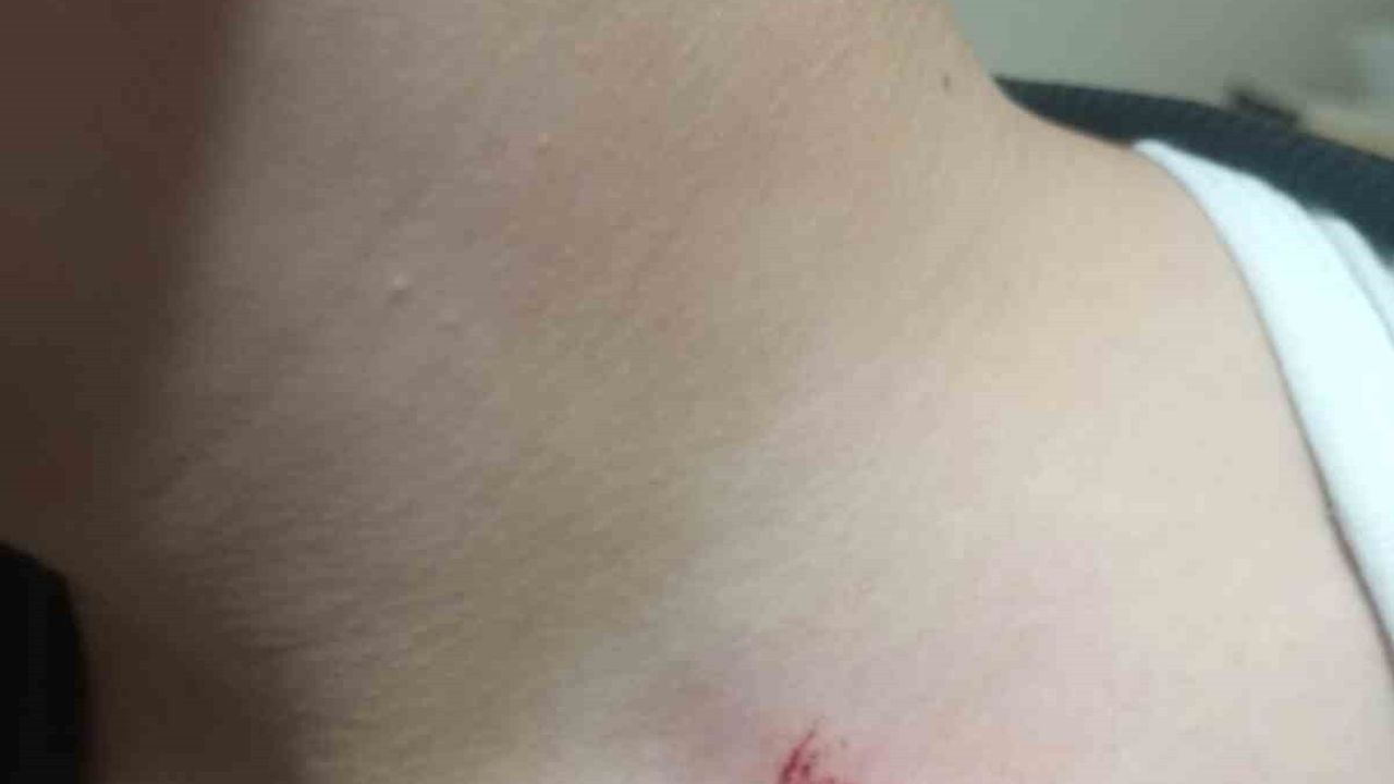 Antalya Kepez'te 7. sınıf öğrencisinin akran zorbalığı iddiasıyla yaralanması