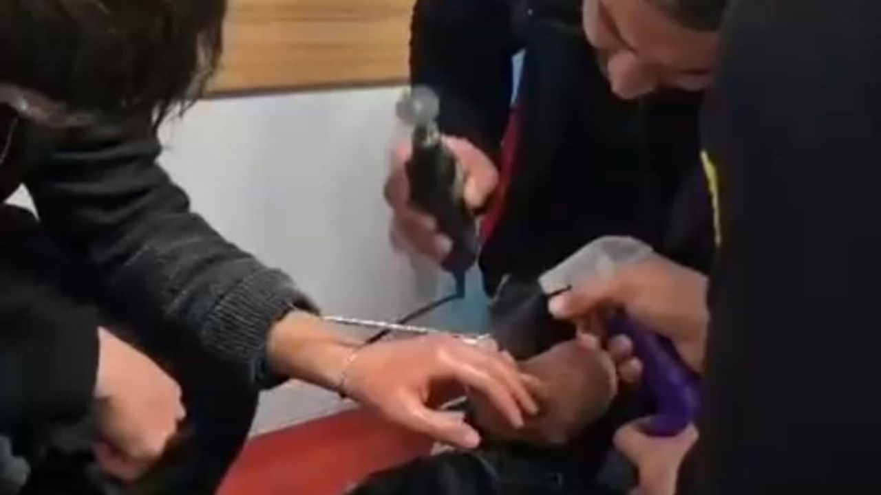 Batman’da parmağına sıkışan yüzük itfaiye tarafından spiral makineyle çıkarıldı