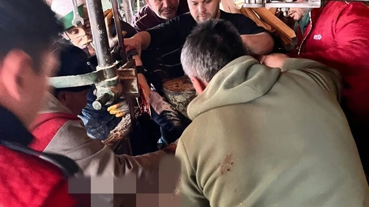 Boyabat’ta iş kazası: İşçi hızar makinesine kolunu kaptırdı, ağır yaralandı