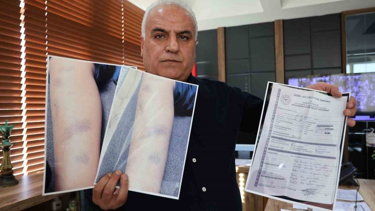 Diyarbakır’da 8 yaşındaki öğrencinin darbedildiği iddiası: Okul ve aile karşılıklı açıklama yaptı