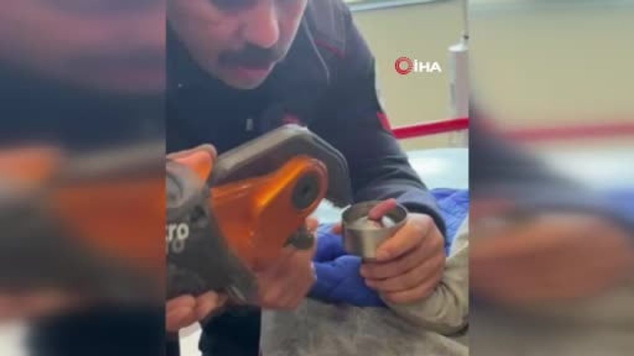 Elazığ'da Parmağı Çelik Küllüğe Sıkışan 1 Yaşındaki Çocuğun İmdadına İtfaiye Yetişti