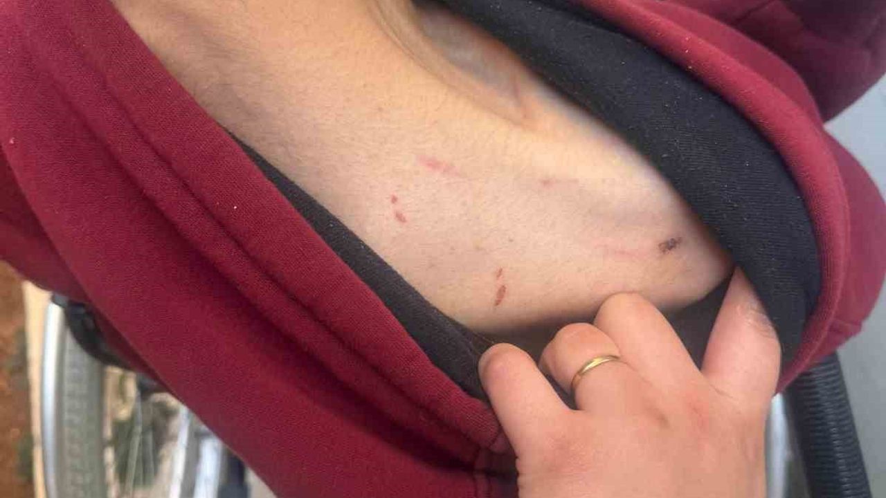 Gaziantep'te engelli bakım merkezinde darp iddiası: 28 yaşındaki Furkan Kaya'nın kafasına 6 dikiş atıldı