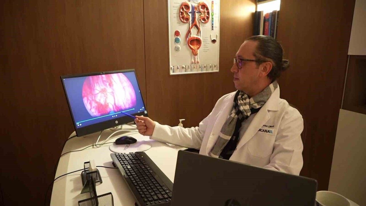 HOLEP yöntemiyle prostat temizliği: 400 grama kadar doku güvenle çıkarılabiliyor