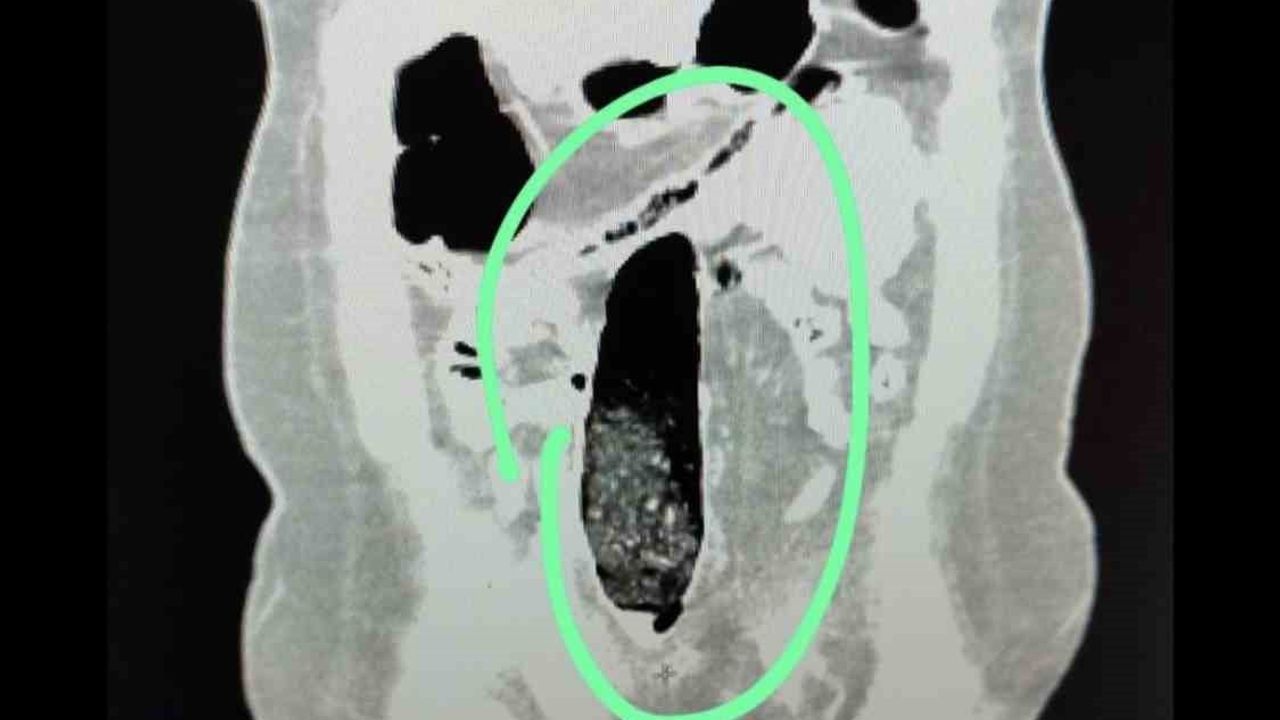 Muş’ta otobüste uyuşturucu sevkiyatına müdahale: 2 İran uyruklu tutuklandı