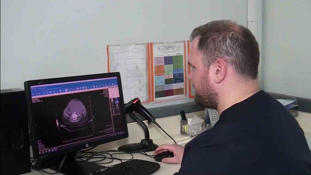 Şanlıurfa'da 25 santimetre çapındaki kist Balıklıgöl Devlet Hastanesi'nde ameliyatla çıkarıldı