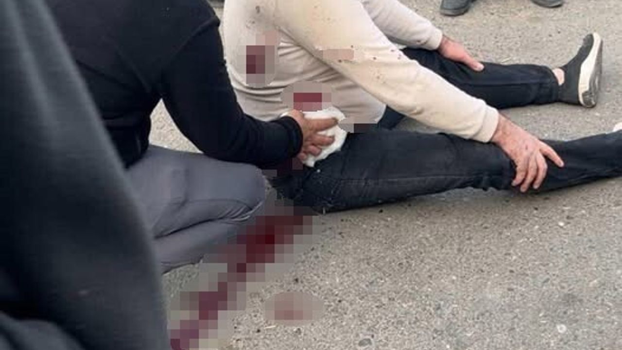 Şanlıurfa'da bıçaklı kavgada 1 kişi ağır yaralandı