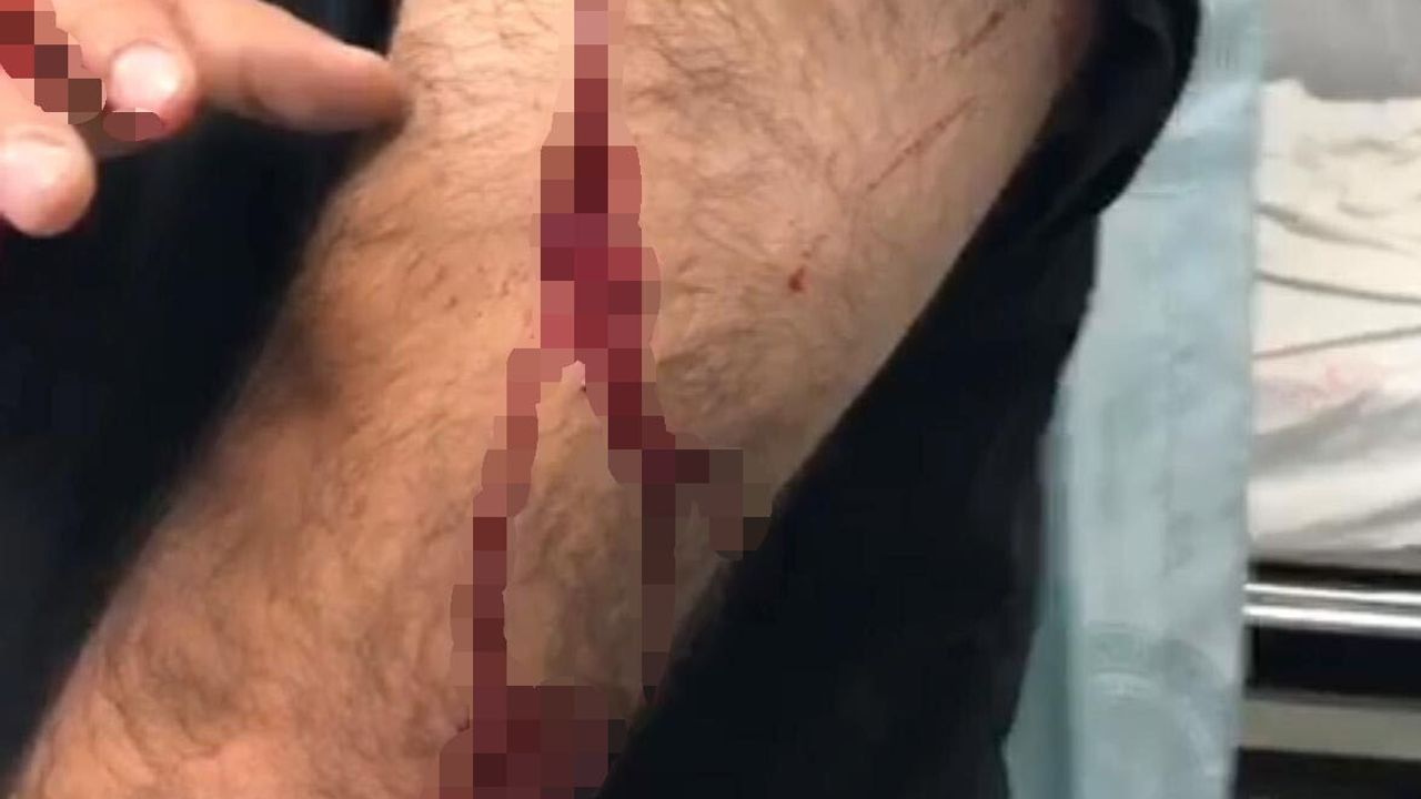 Şanlıurfa Karaköprü'de Öğretmene Jiletli Saldırı: Doğukent Mahallesi'nde Park Halindeki Aracına Yaklaşan Şüpheli Yaraladı