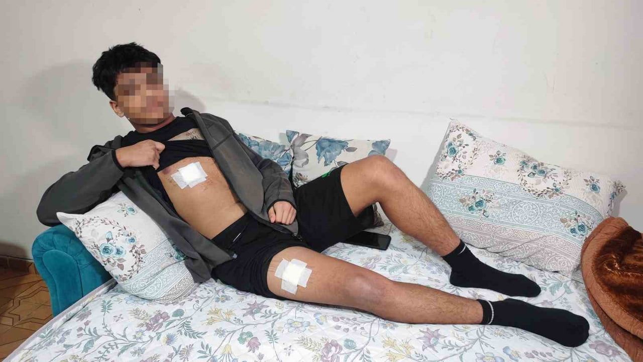 Adana'da 15 yaşındaki genç bıçaklı saldırıdan kurtuldu: 2 tutuklama, bıçaklayan şüpheli aranıyor