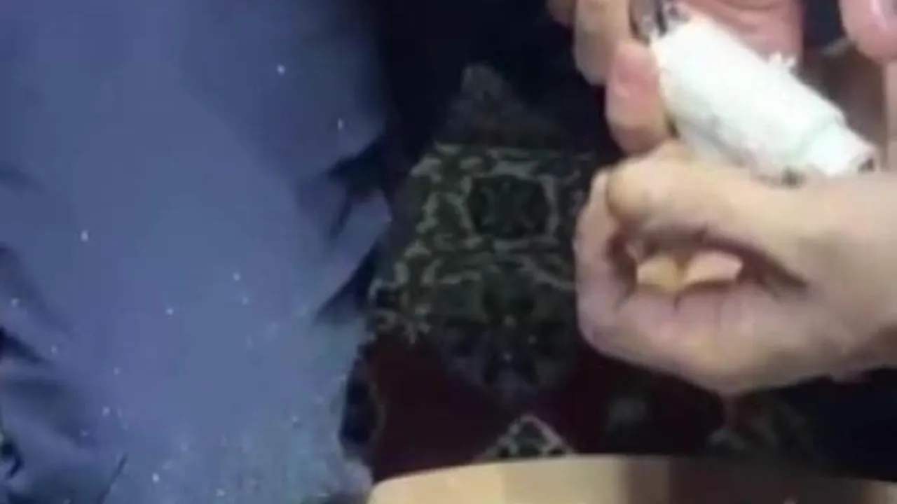 Adana'da kombi borusuna sıkışan parmağı Cankur ekipleri kurtardı