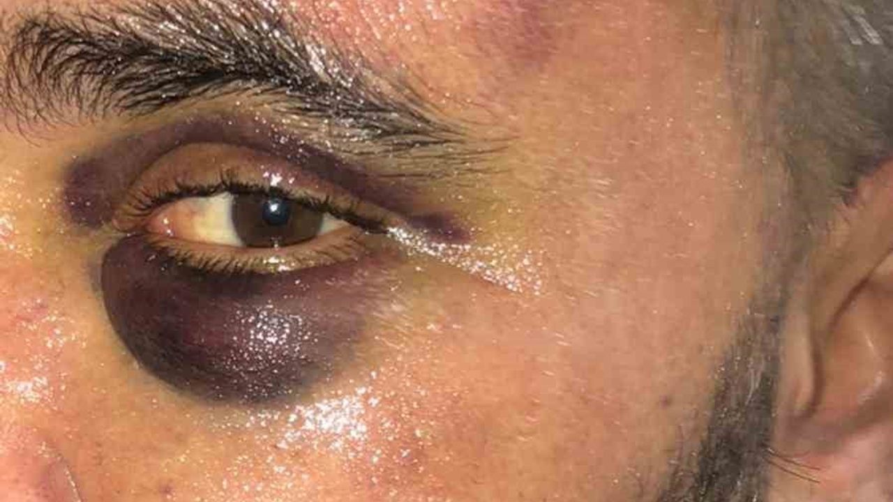 Afyonkarahisar'da Dükkanına Giren 3 Kişi Tarafından Darp Edilen İş Yeri Sahibi Hastaneye Kaldırıldı, Şüpheliler Serbest Bırakıldı