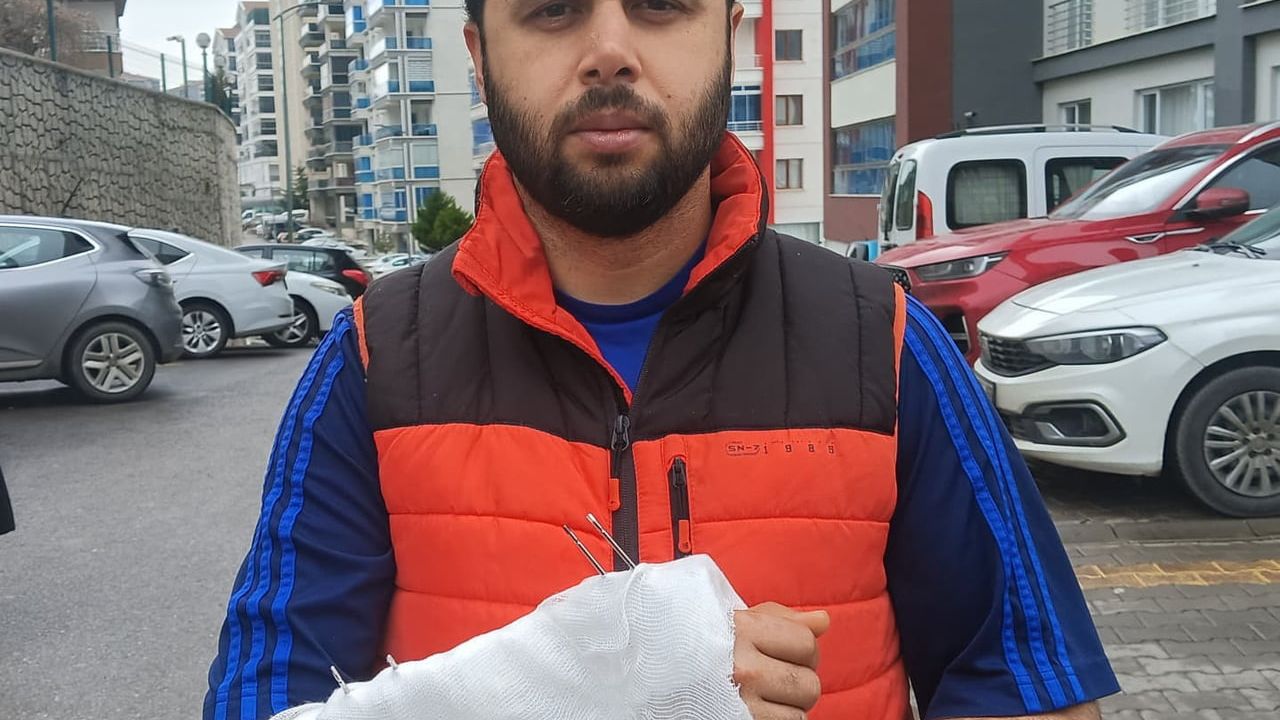 Ankara Mamak'ta Sahipsiz Köpeklerden Kaçarken Düşen Kişi Bileğini Kırdı: Yasin Arslantaş'ın İddiaları ve Sağlık Durumu