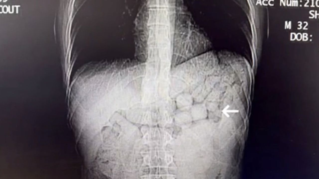 Diyarbakır'da midelerinde 807,15 gram uyuşturucu taşıyan iki İranlı tutuklandı