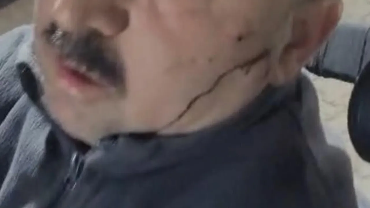 Elmadağ'da mobilya fabrikasında işçi, patron ve oğlunun darbettiğini iddia etti