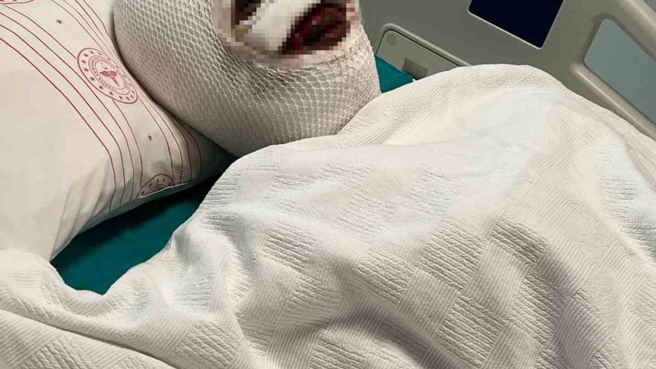 Gaziantep'te eski eşi başına kimyasal madde döktü: S.Ç yoğun bakımda, saldırgan tutuklandı