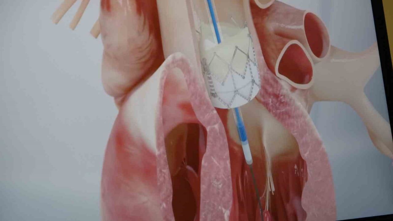 Gençlerde ani ölümlerin yüzde 90'ı genetik nedenlere bağlı, Prof. Dr. Hasan Pekdemir uyardı