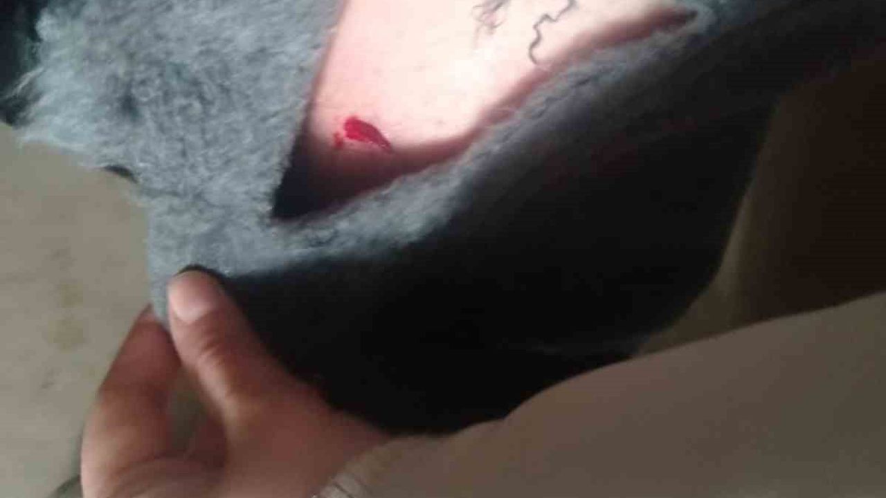 Kayseri Tomarza'da sokak köpeği saldırısı: Kız çocuğu hastaneye kaldırıldı, zabıta amiri hakkında soruşturma